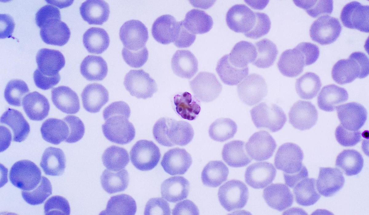 Plasmodium Vivax Inside Red Blood Cell in the Stage of Ring-form  Trophozoite Stock Illustration - Illustration of protozoan, smear: 158753232